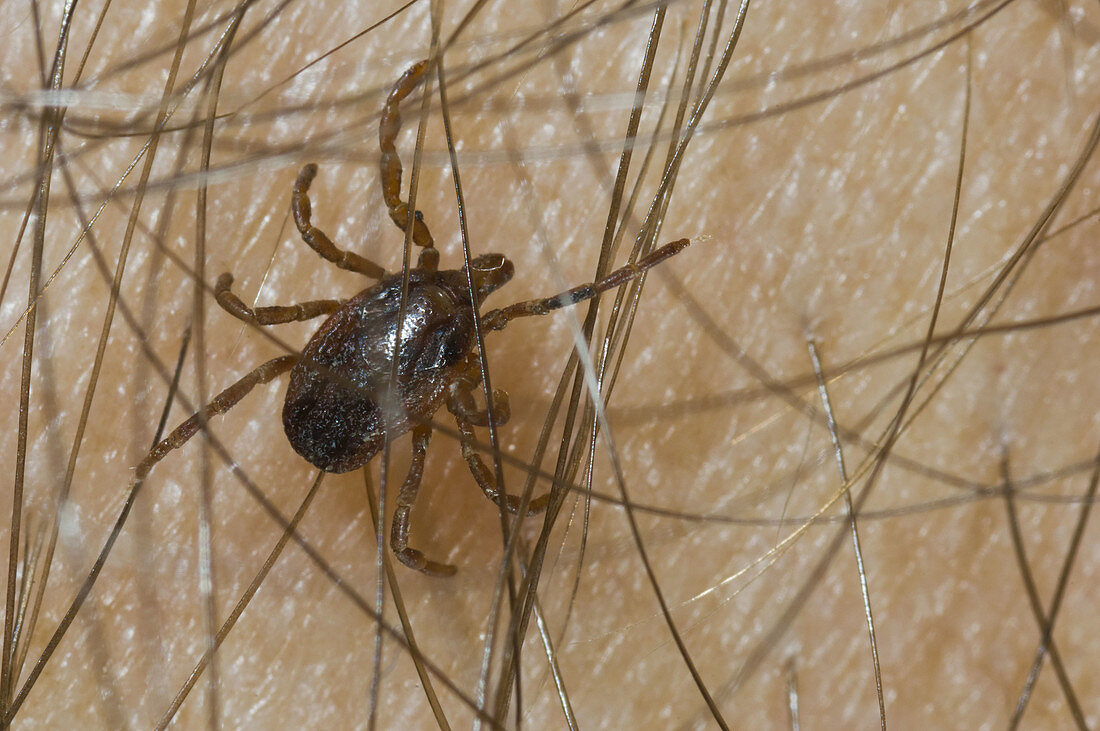 Acarid, Acarids, Animal, Animals, Arachnid, Arachnids, Close up, Close-up, Closeup, Color, Colour, Detail, Details, Disease, Diseases, Hair, Hairs, Health, Hyalomma lusitanicum, Little, Lyme disease, Medical, Medicine, Nature, One, Parasite, Parasites, Pa