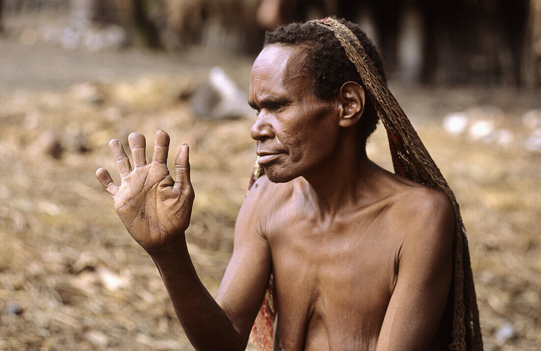 Dani woman with cut fingers as a mourning sign, Baliem valley, Western Papuasia, Former Irian-Jaya, Indonesia