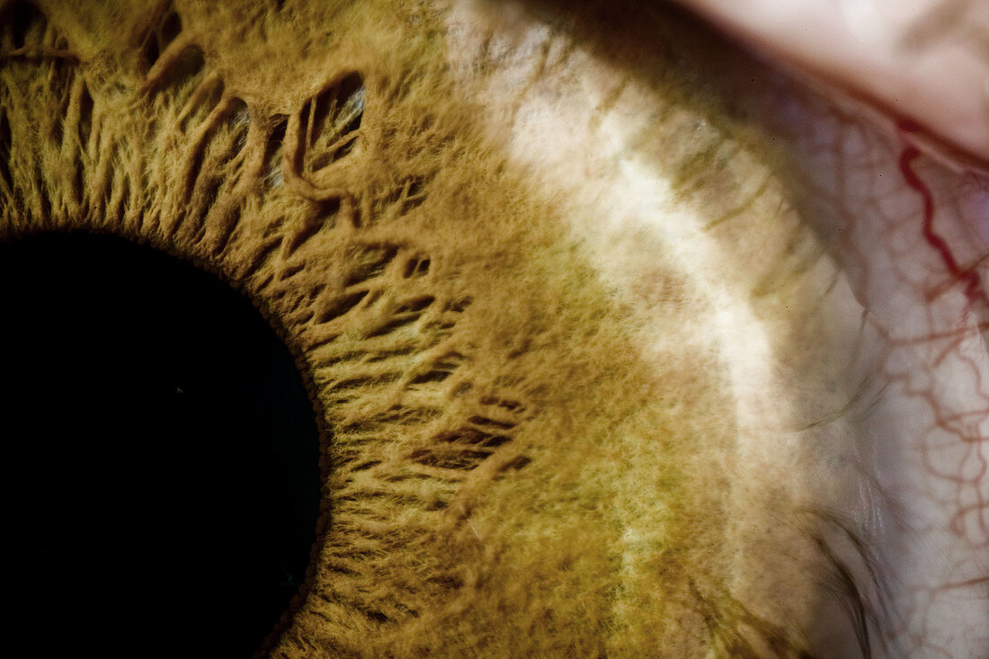 Closeup of eye