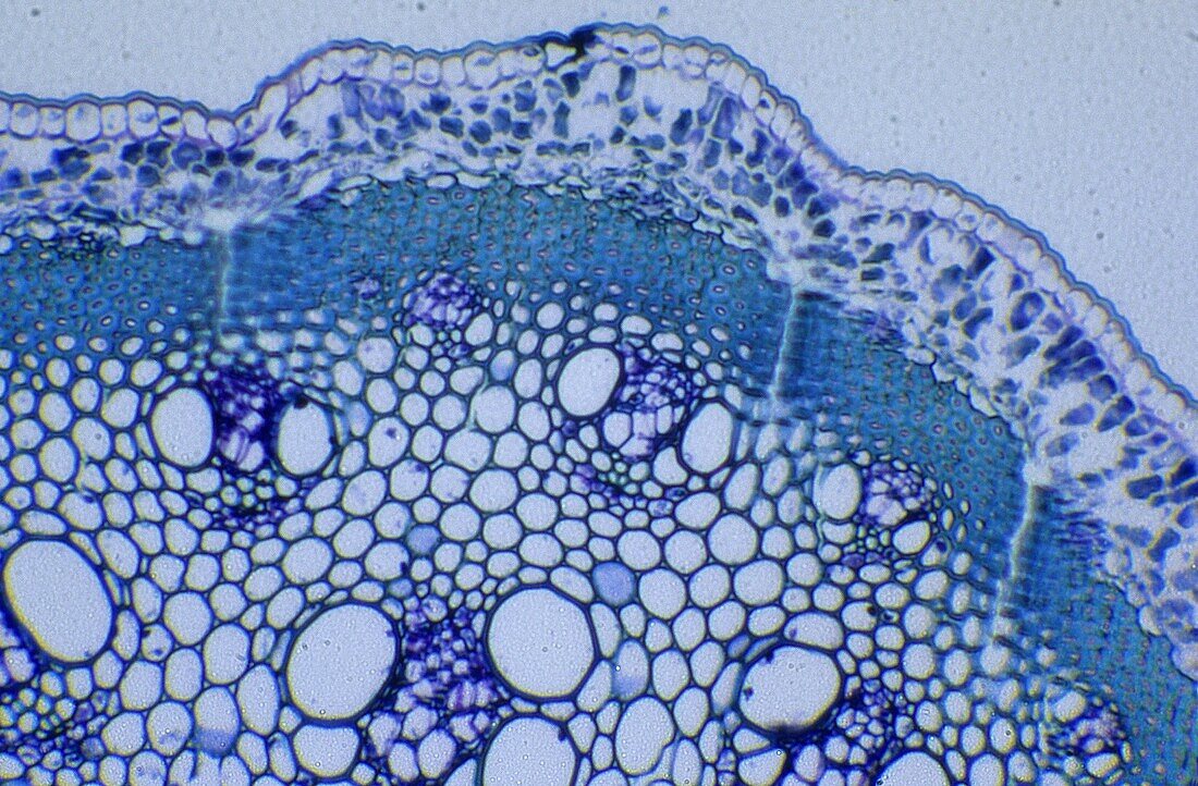 Stoma Asparagus stem 60x