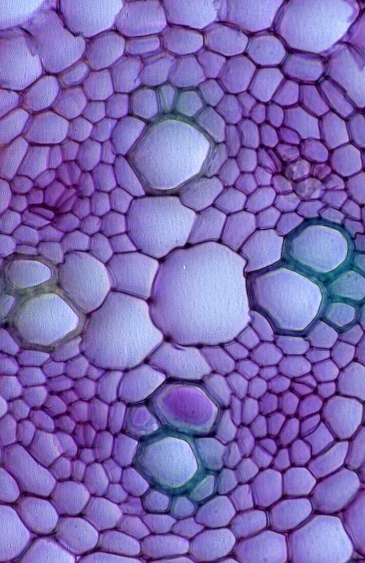 Phloem and xylem vessels Root of Dicotyledonae Buttercup