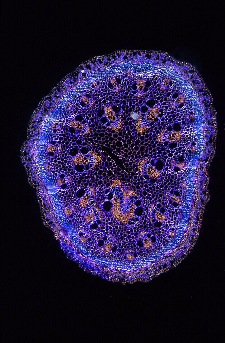 Stoma Asparagus stem 17x