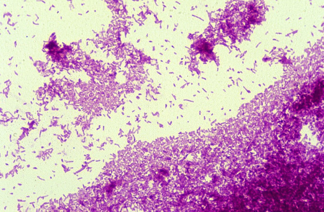 Mycobacterium tuberculosis bacteria