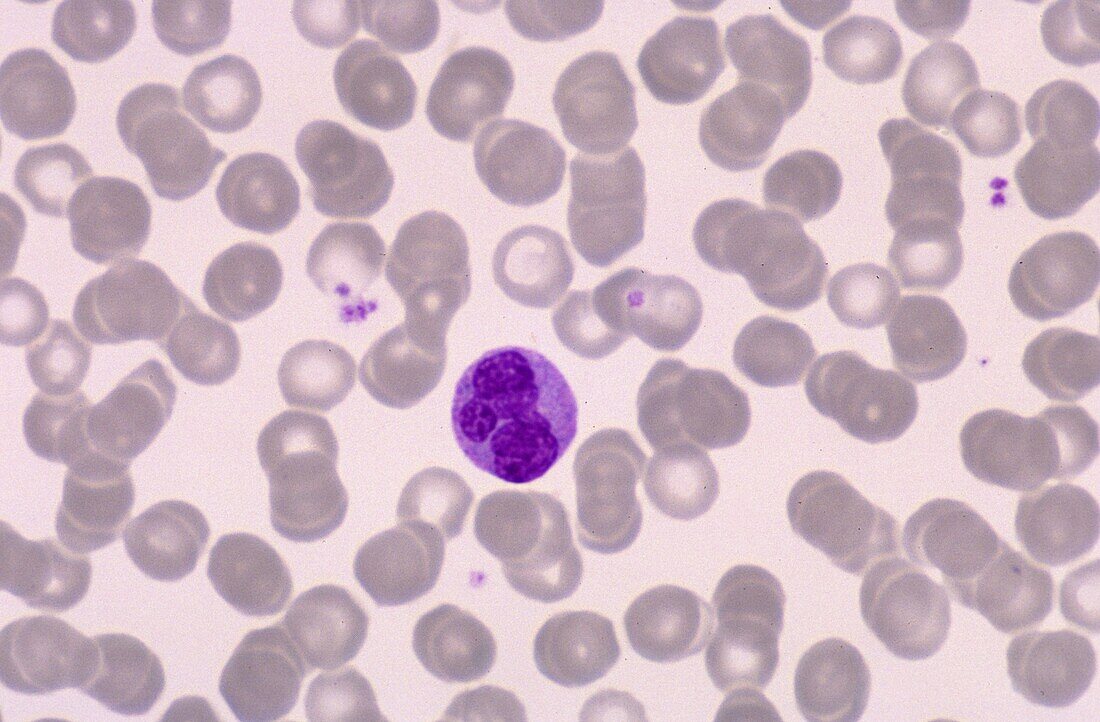 Normal blood cells