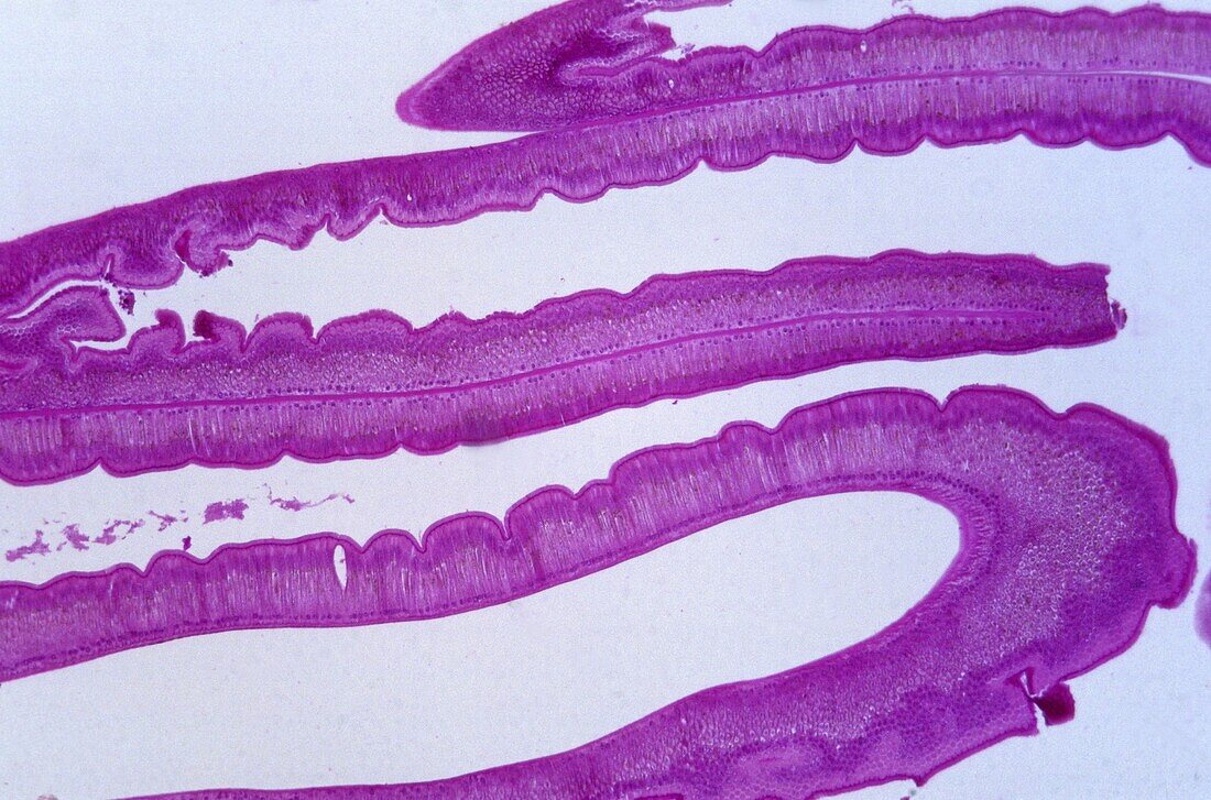 Epithelial cells of intestine of Ascaris 18