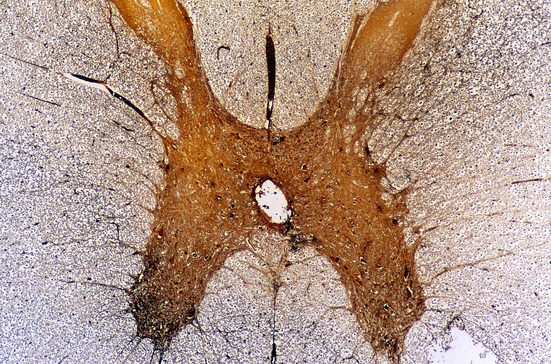 Multipolar neuron of the spinal cordon Nervous tissue 14x