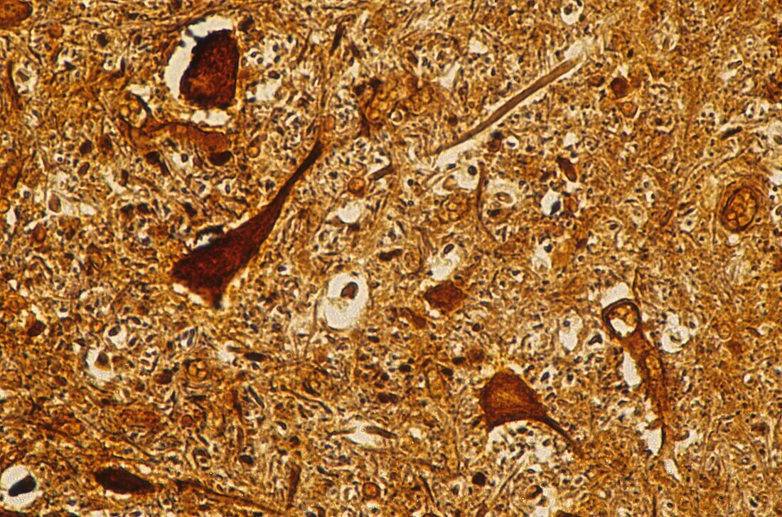 Multipolar neuron of the spinal cordon Nervous tissue 140x