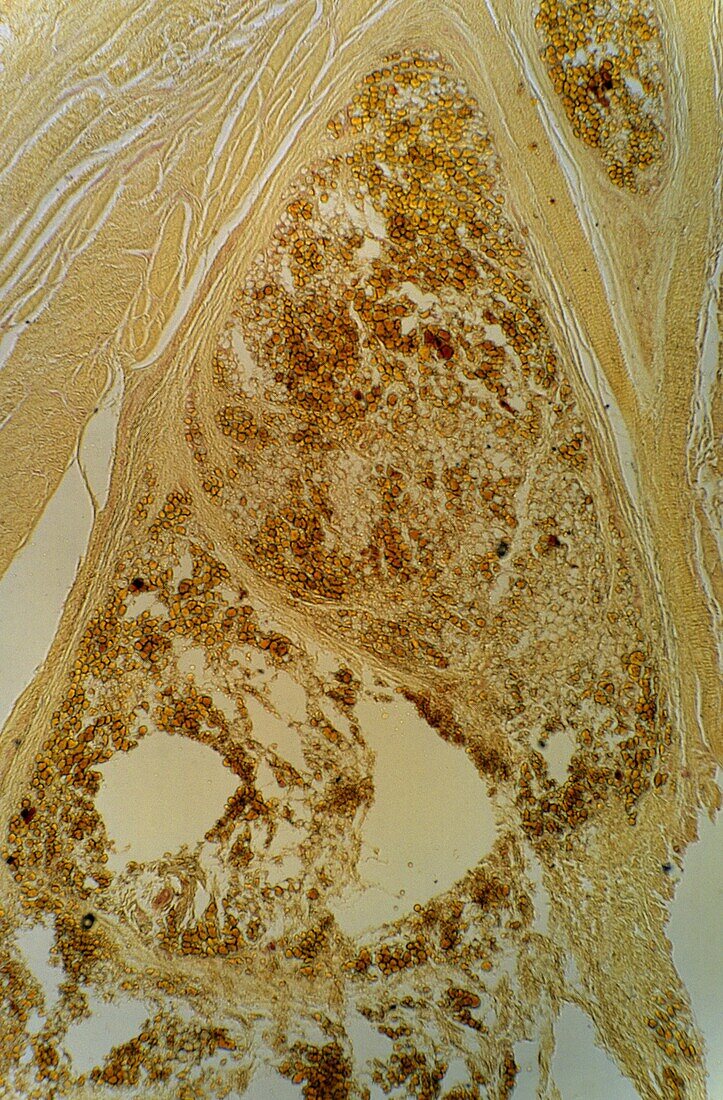 Fat cells Adipose tissue