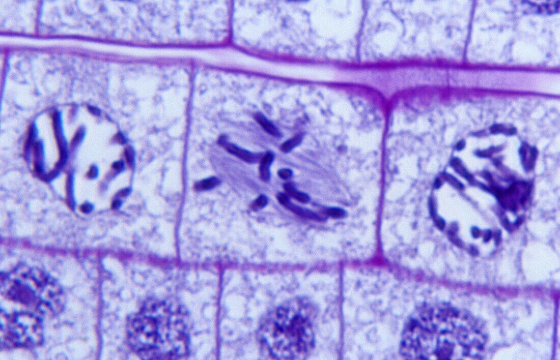 Onion mitosis root tip