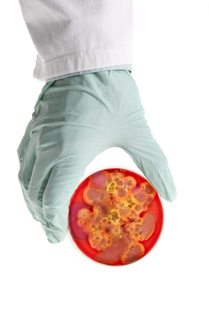 A lab technician holding a Petri dish with a bacteria culture growing in it, close-up of the hand