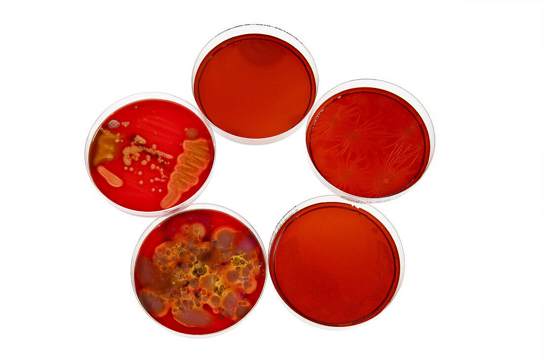 Petri dishes holding different stages of bacteria cultures