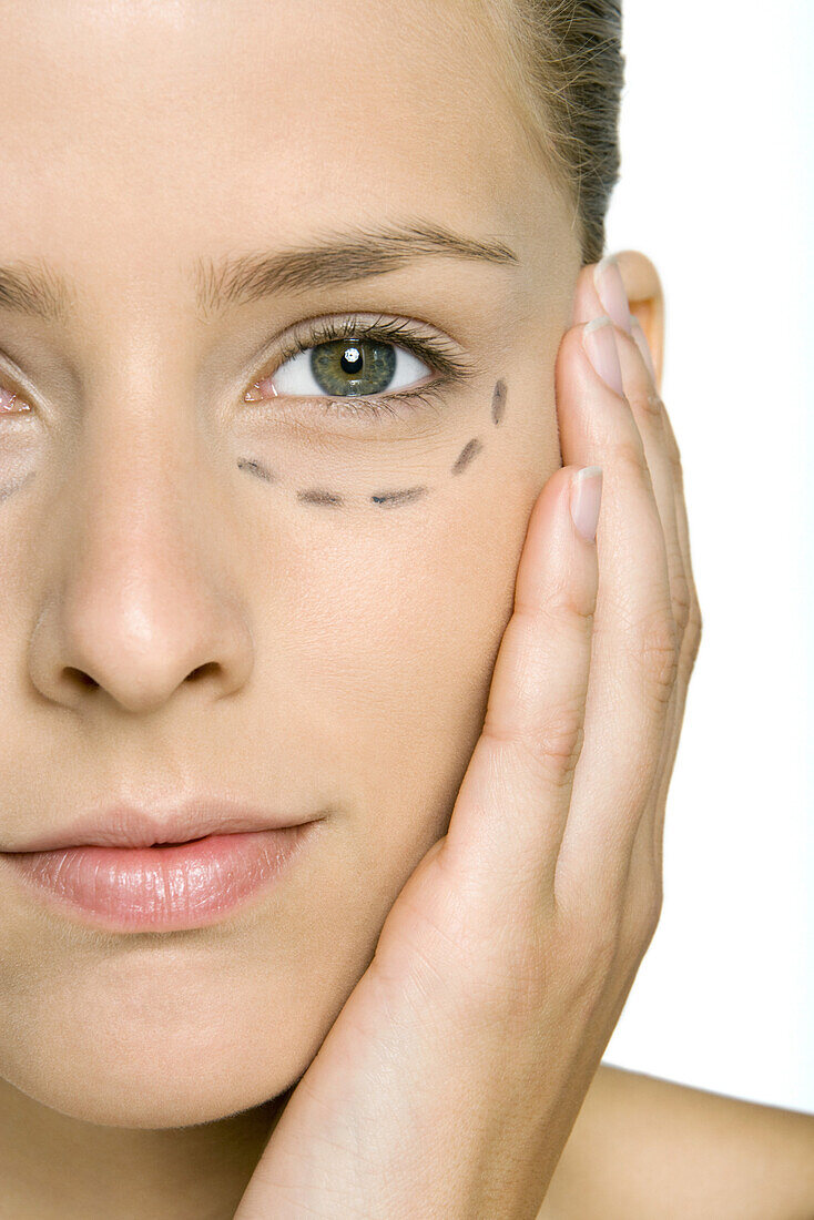 Woman with plastic surgery markings under eye, holding face, looking at camera, cropped