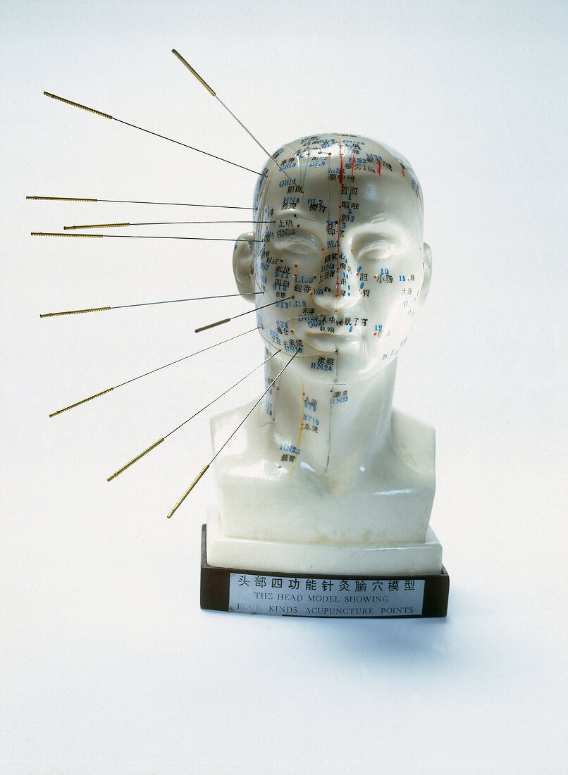 Kopf a. d. die 650 Akupunkturpunkete genau festgelegt sind, Nadeln