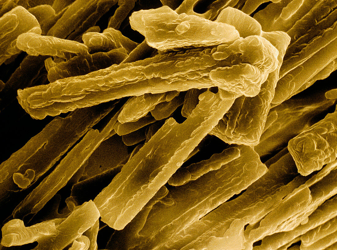 SEM of crystals of cholesterol