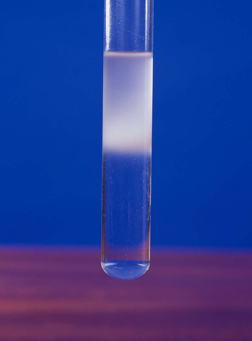 Emulsion test for lipids