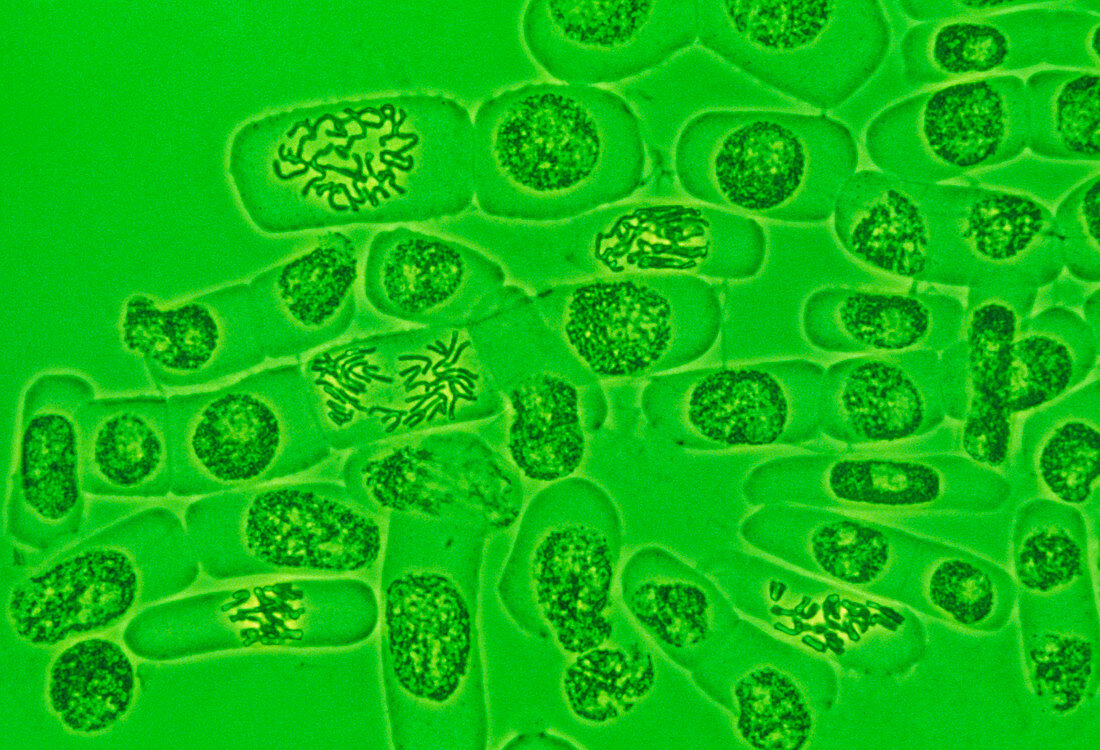 Onion cells undergoing mitosis