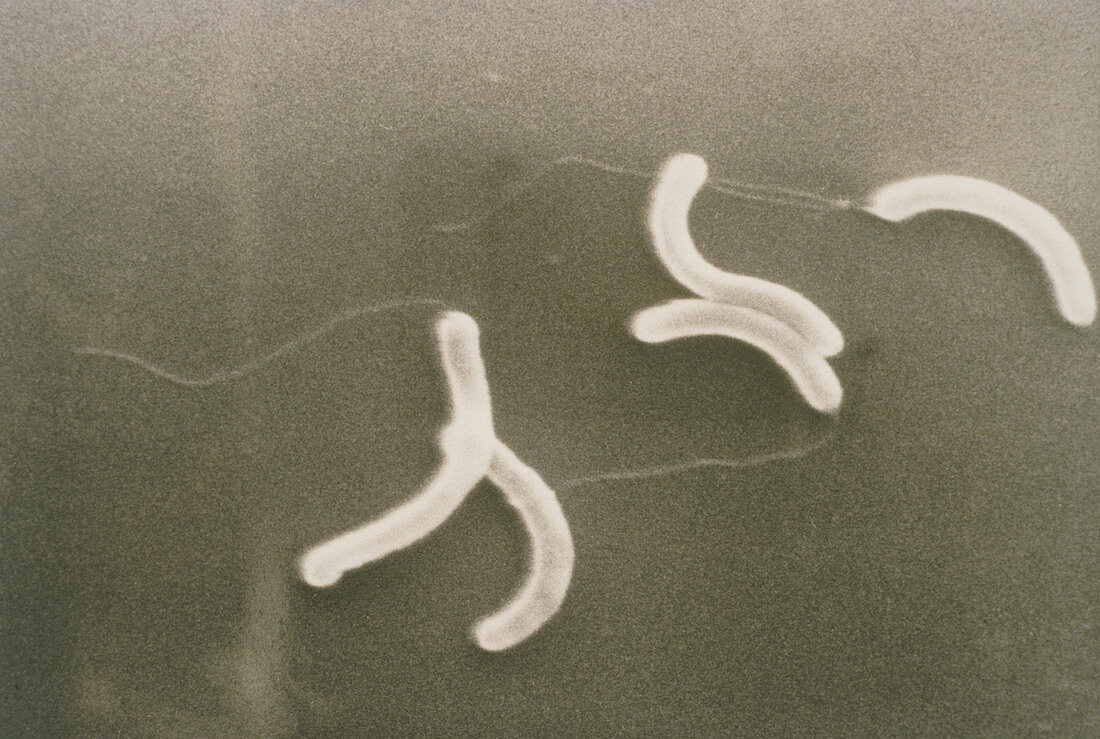 SEM of the bacterium Vibrio cholerae