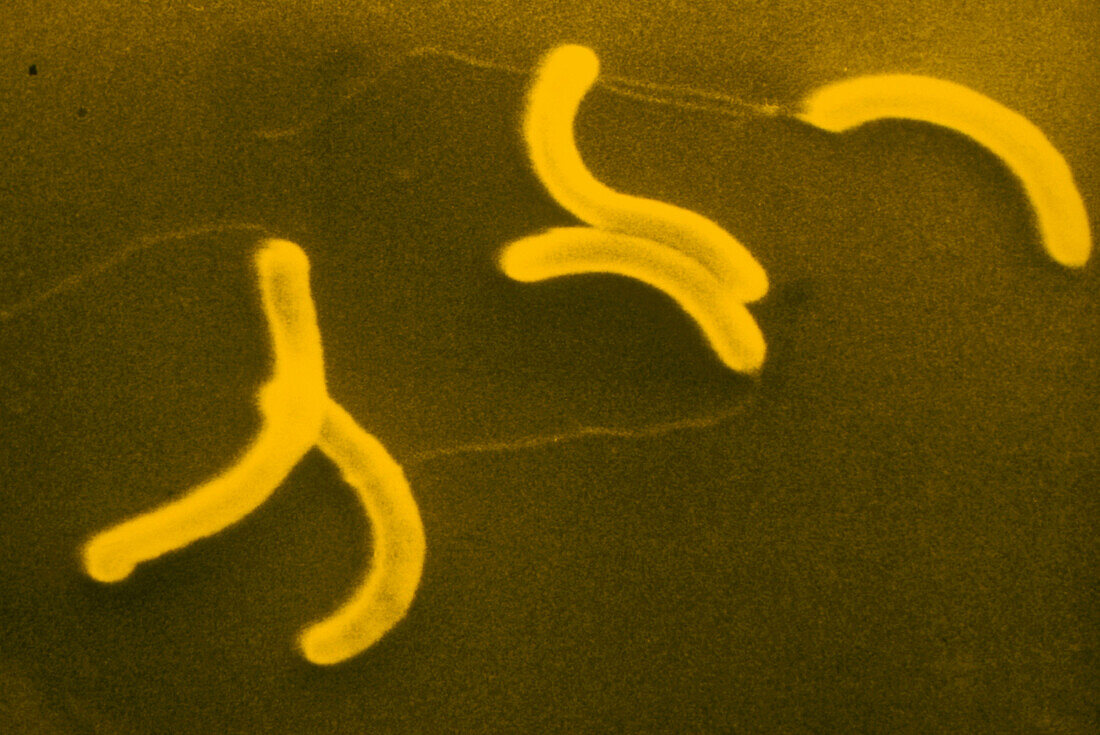 SEM of Vibrio cholerae bacterium