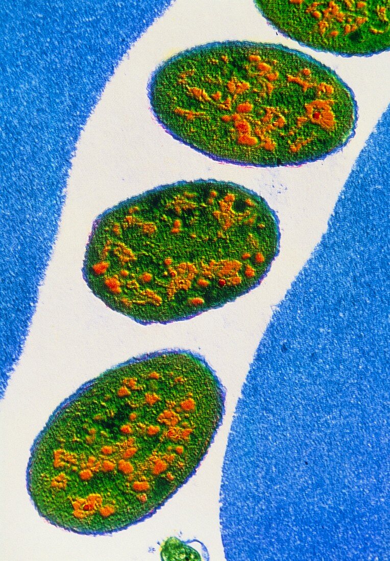 Coloured TEM of Borrelia sp. bacteria