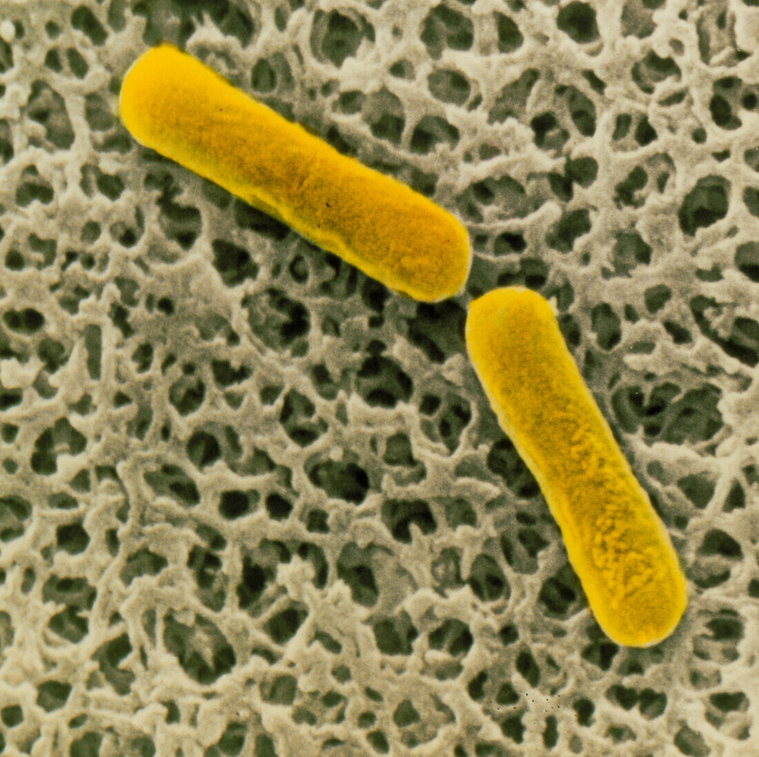 SEM of clostridium botulinum bacteria