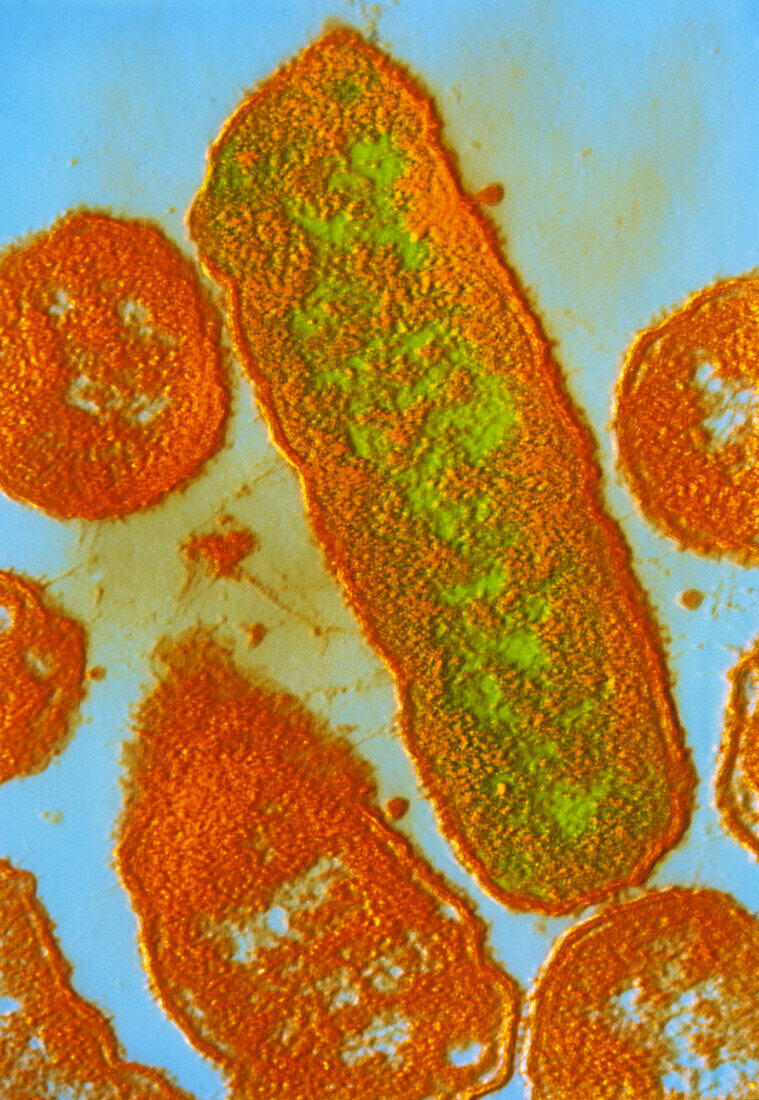 Haemophilus ducreyi bacteria