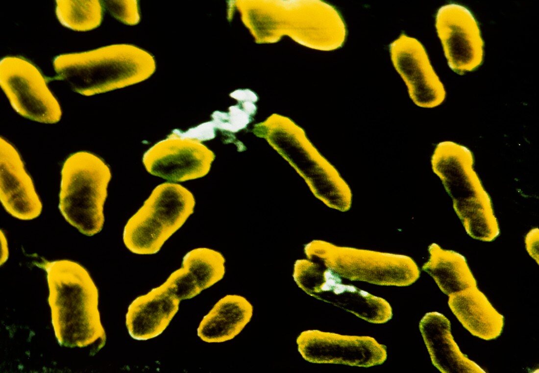 Coloured SEM of Proteus sp. bacteria