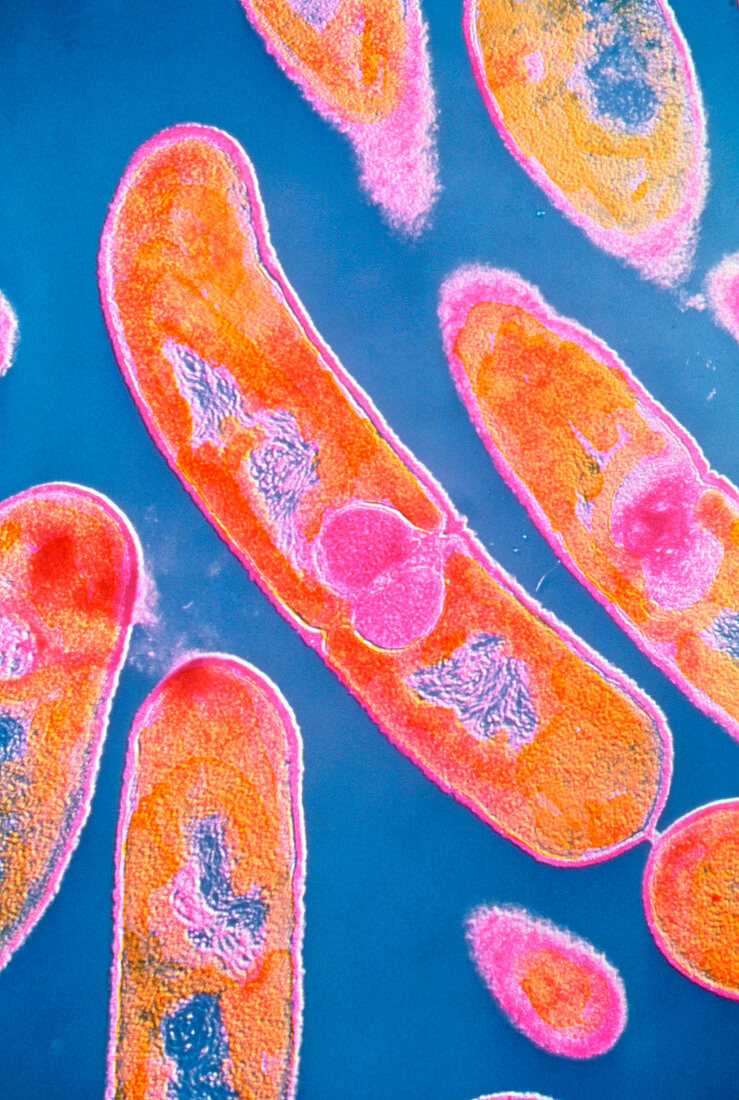 Coloured TEM of Listeria sp. bacteria