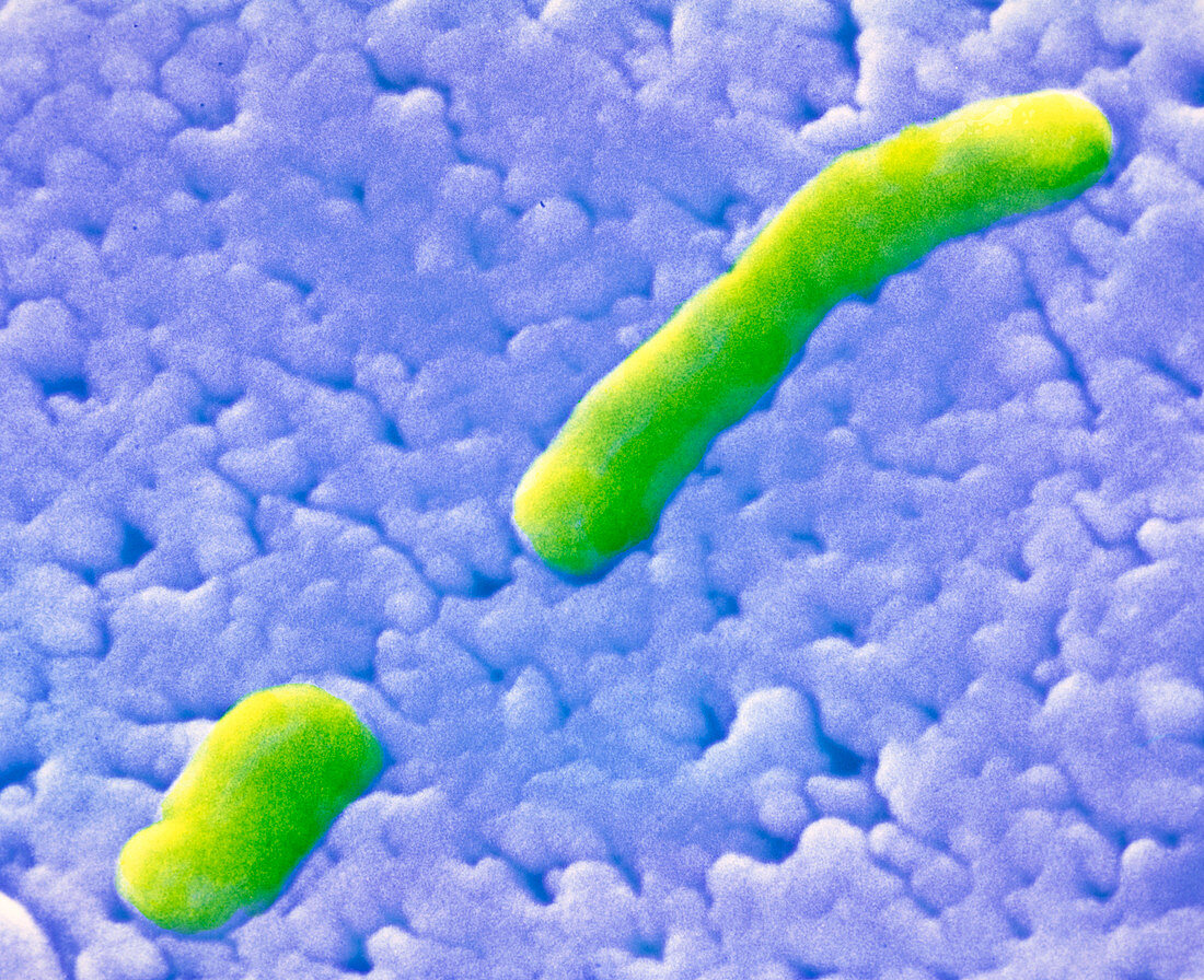 Haemophilus influenzae bacteria