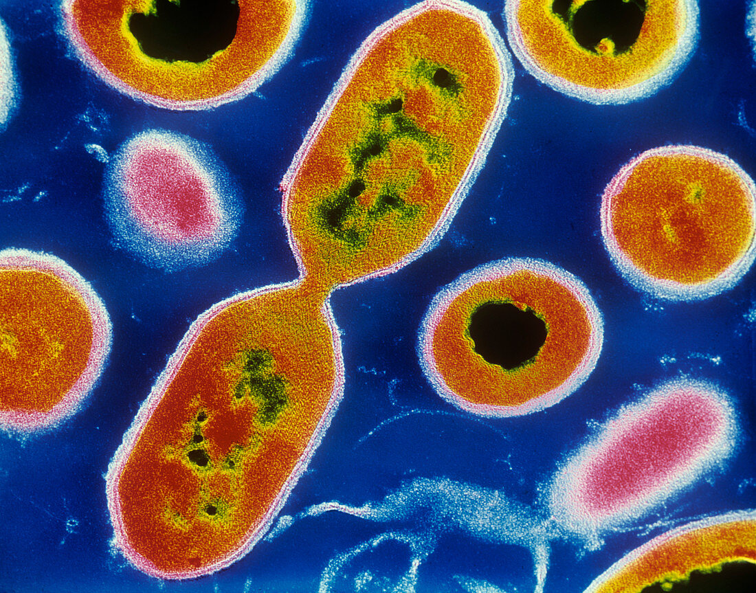 Coloured TEM of Listeria sp. bacteria