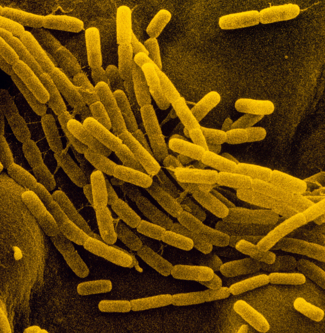 SEM of a colony of Bacillus cereus