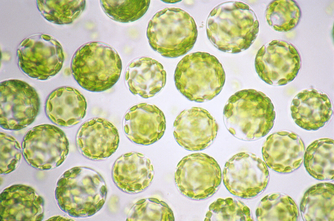Protoplasts in tobacco leaf cells