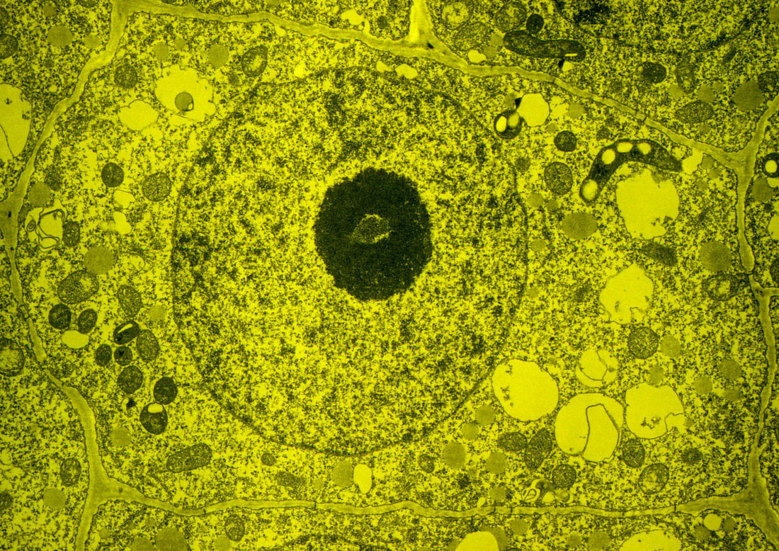 TEM of plant cell from root tip of maize