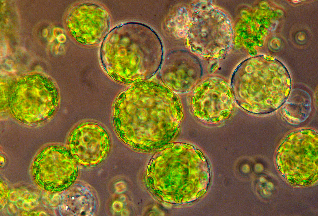Protoplasts from a tobacco leaf