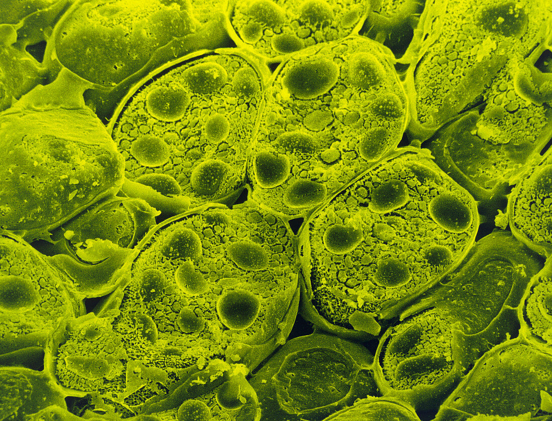 SEM of starch grains in cell of Jack bean plant