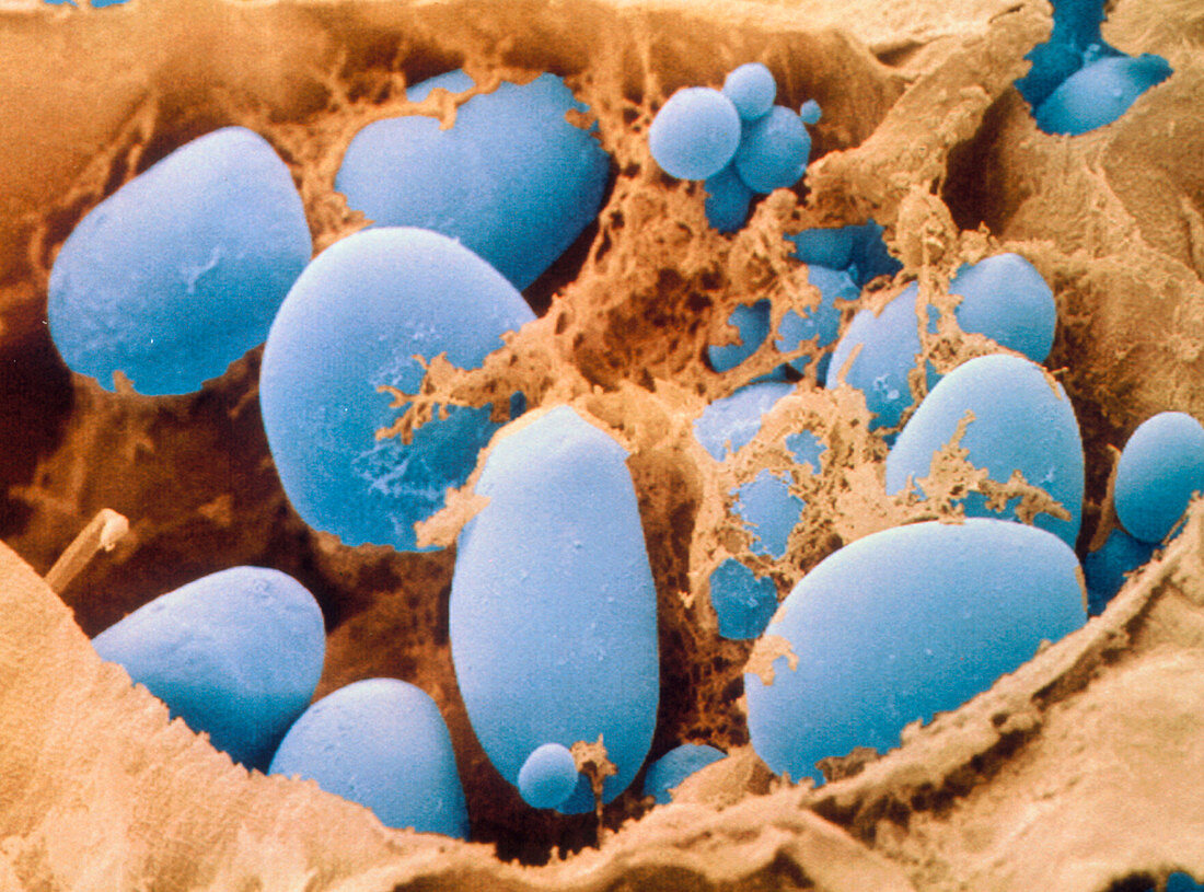 Starch grains in potato cells