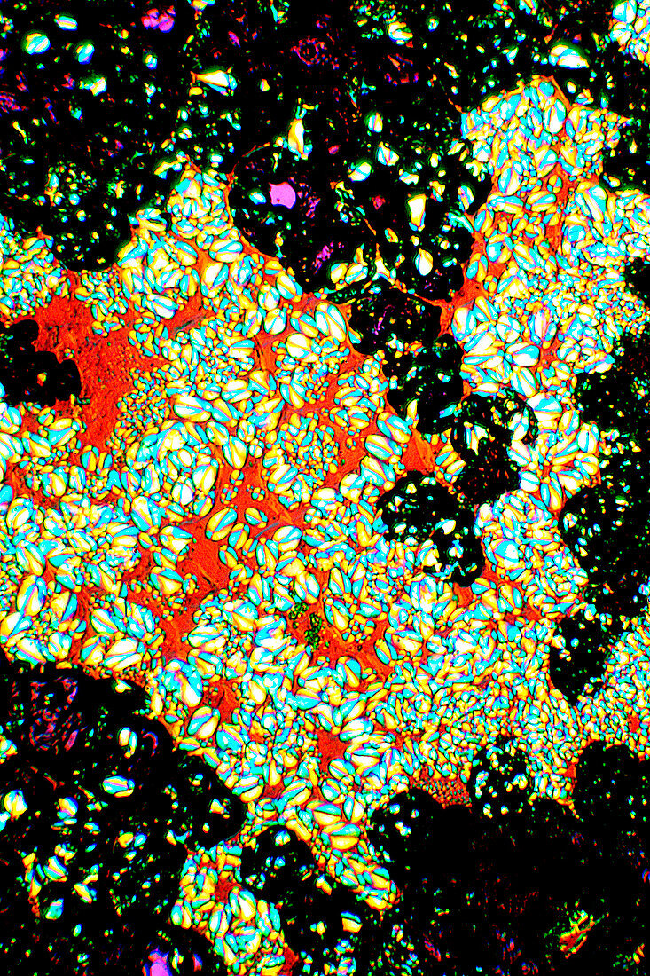 Starch grains in potato,light micrograph
