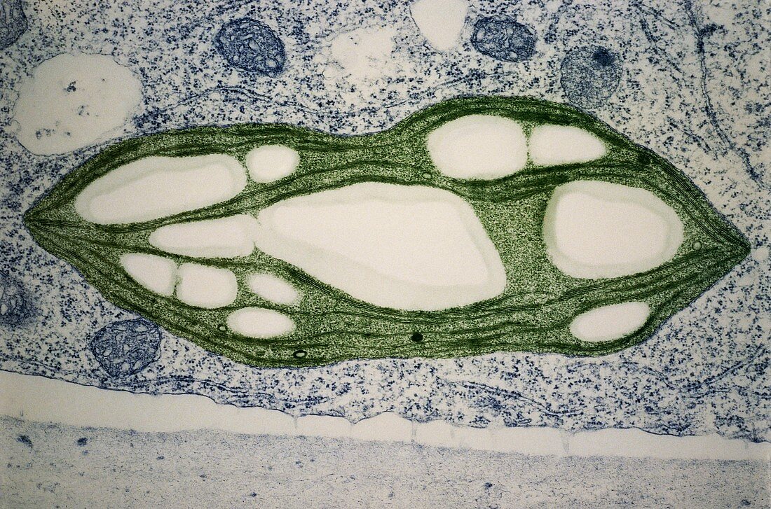 TEM of a chloroplast