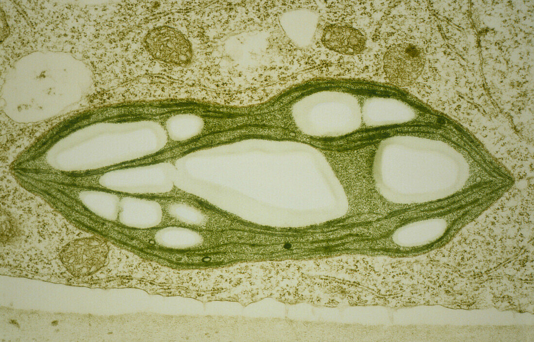Chloroplast in protonema of moss