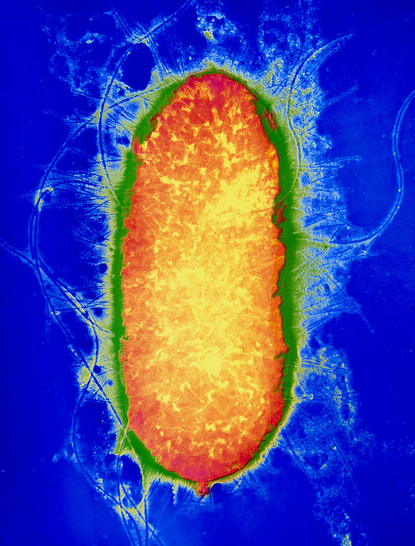 Erwinnia chrysanthemi bacterium