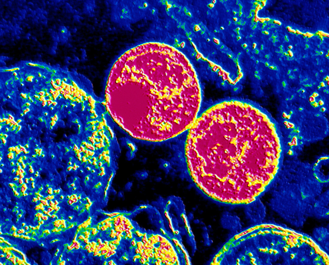 TEM of chlamydia trachomatis bacteria