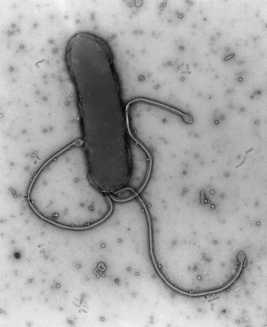 TEM of a Helicobacter pylori bacterium