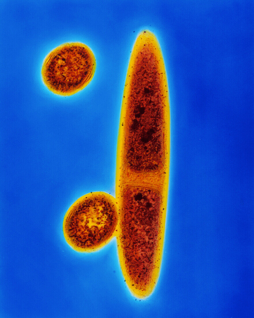 Methanospirillum hungatii bacteria