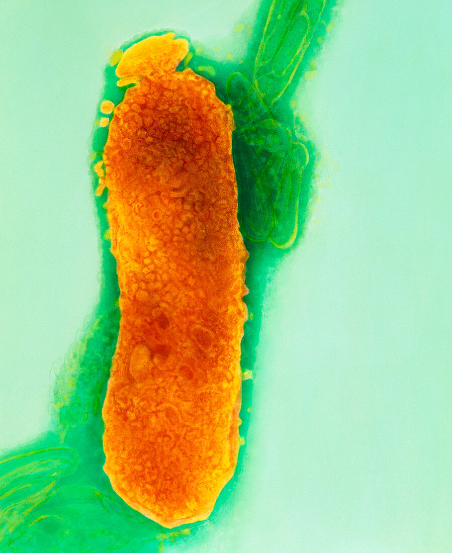 TEM of Fusobacterium necrophorum
