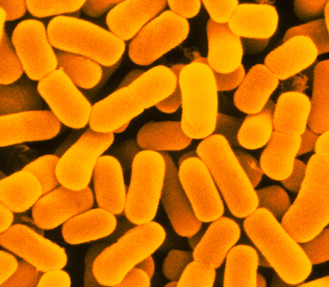 Coloured SEM of Lactobacillus bucherni