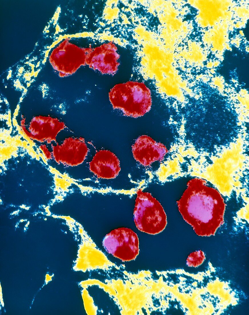 Chlamydia bacteria in coronary artery