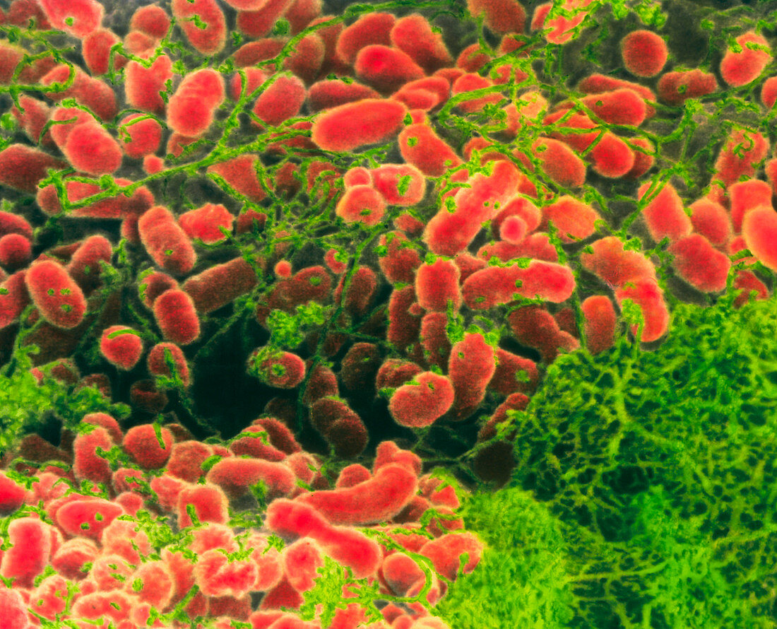 SEM of actinobacillus bacteria cluster