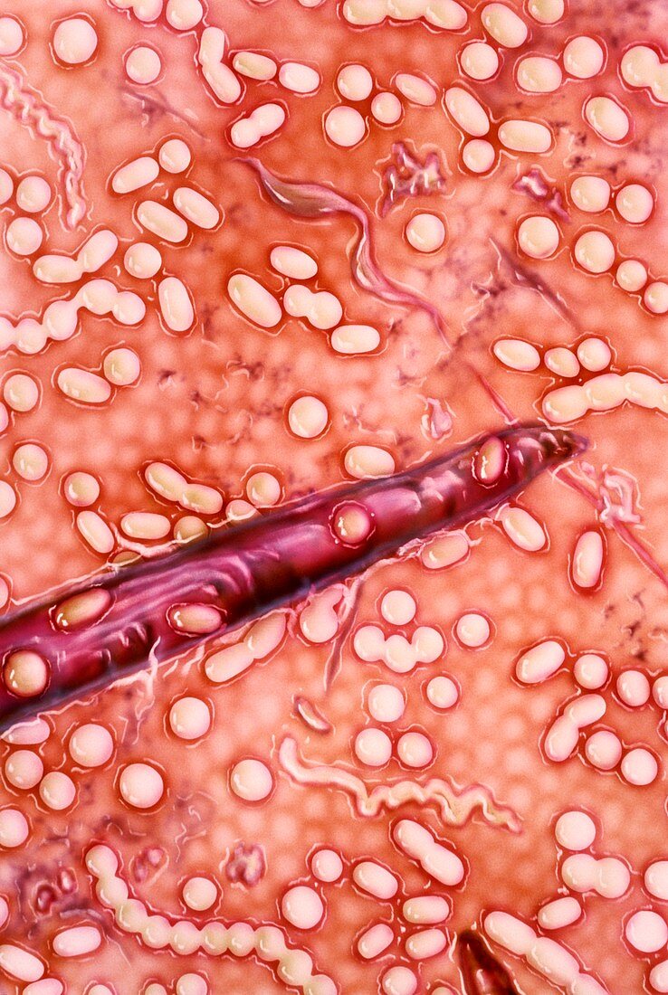Artwork of bacteria in large intestine