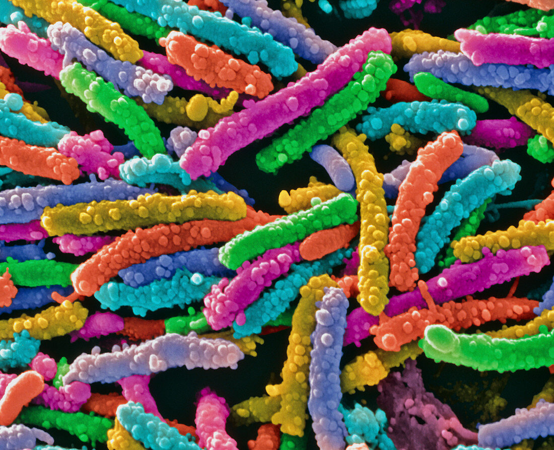 Unidentified rod-shaped bacteria