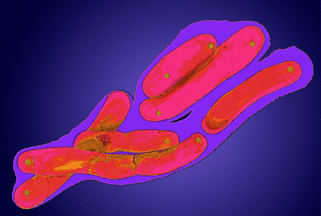 Mycobacterium tuberculosis bacteria