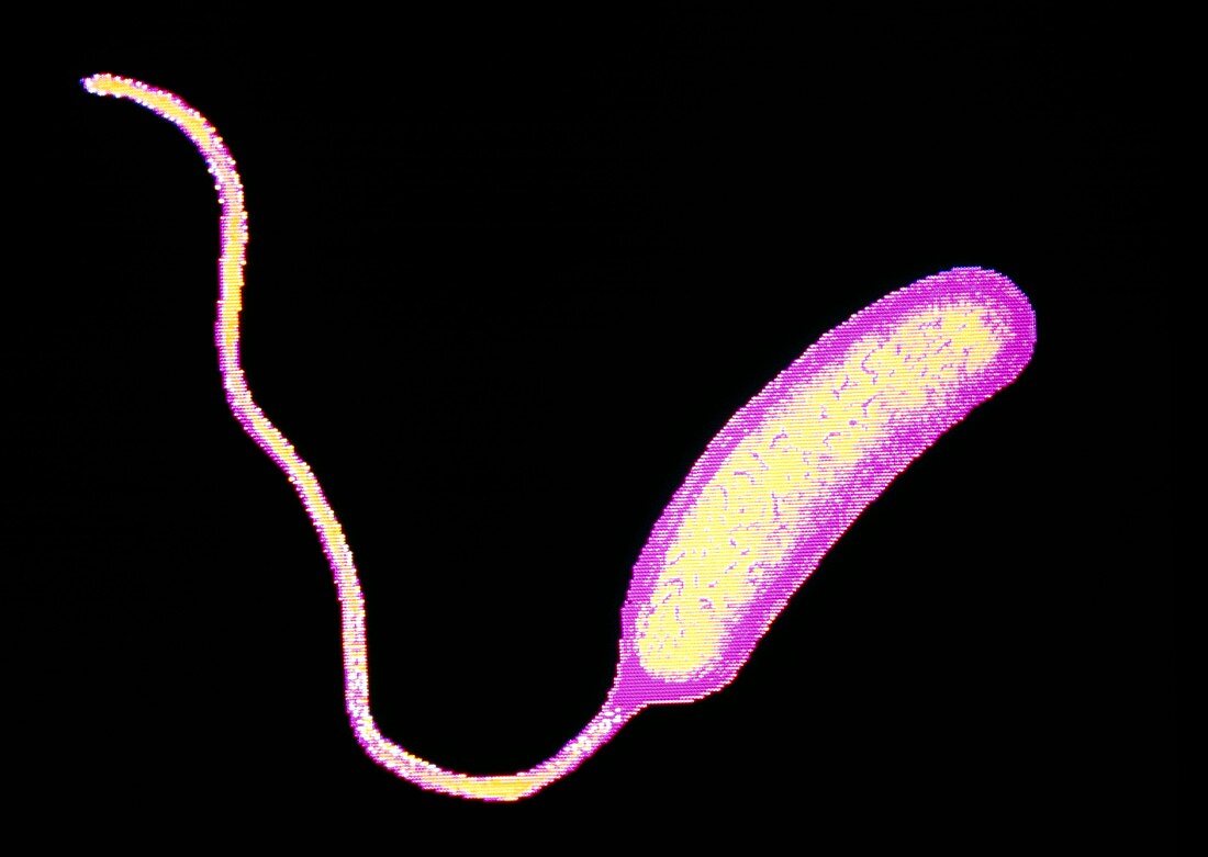 F-col TEM of Vibrio cholerae bacterium